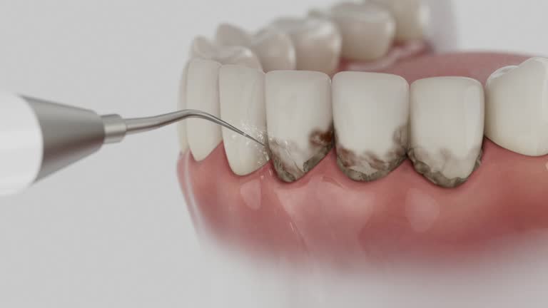 Trusted Dental Implants service in Shinglehouse, PA - Dentist Open Now
